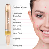 Dr. Pen M5 Dr.pen +2 Cartuchos Microabujas Facial MYM Derma